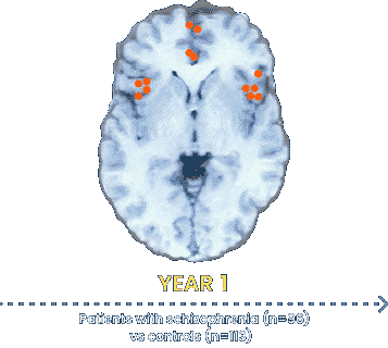 Animated brain activity dots graphic
